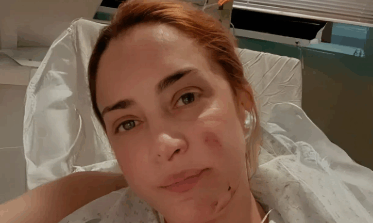 El mensaje de María Julia Oliván contra aquellos que la abandonaron desde que se quemó la cara