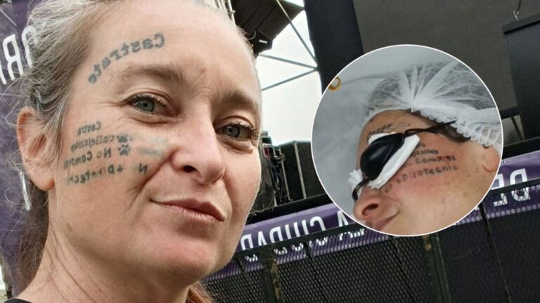 La libertaria Geraldine Prais mostró cómo le quedó la cara tras borrarse los tatuajes: se hizo uno nuevo?