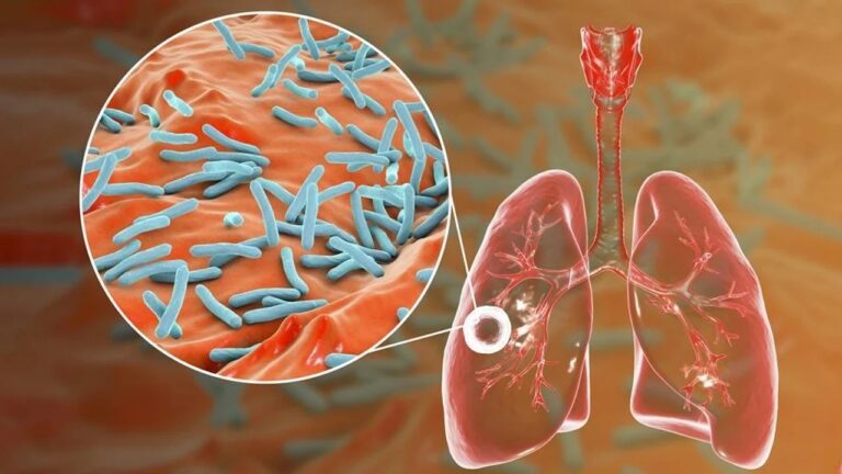Microscopio y muestras de laboratorio en investigación sobre tuberculosis