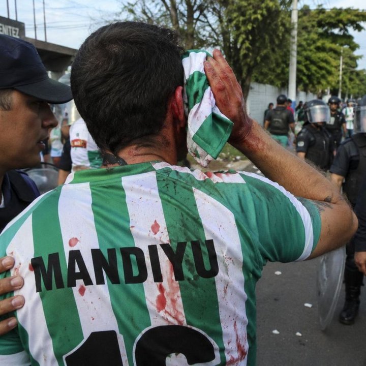 Hincha de Deportivo Mandiyú herido en operativo policial
